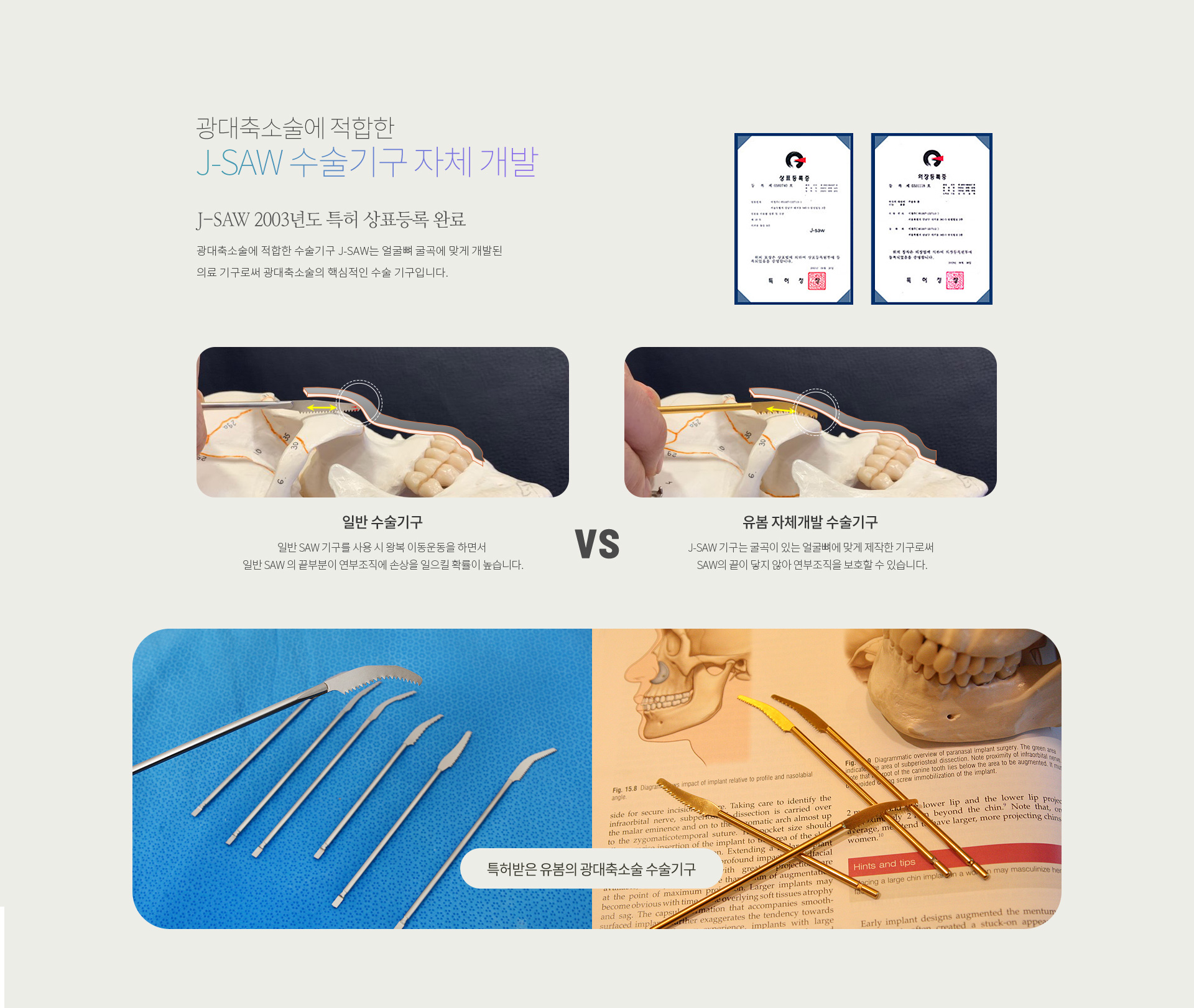 J-SAW 수술